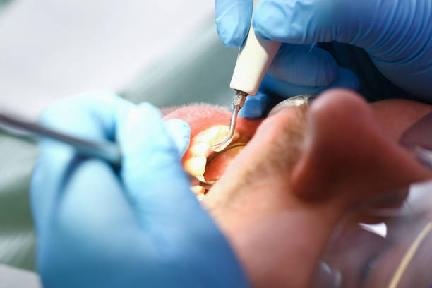 Best Weekend Emergency Dentist in Tahoma, CA