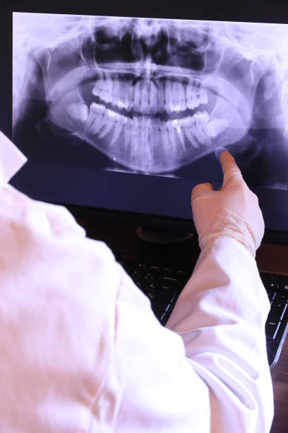Best Emergency Dental Surgery in Tahoma, CA