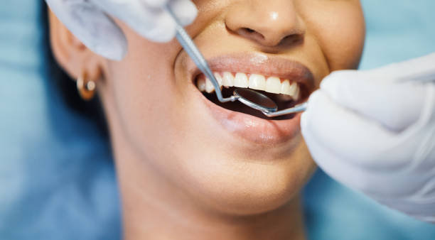 Best Same-Day Emergency Dentist in Tahoma, CA