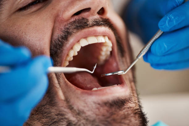 Best Walk-In Emergency Dentist in Tahoma, CA